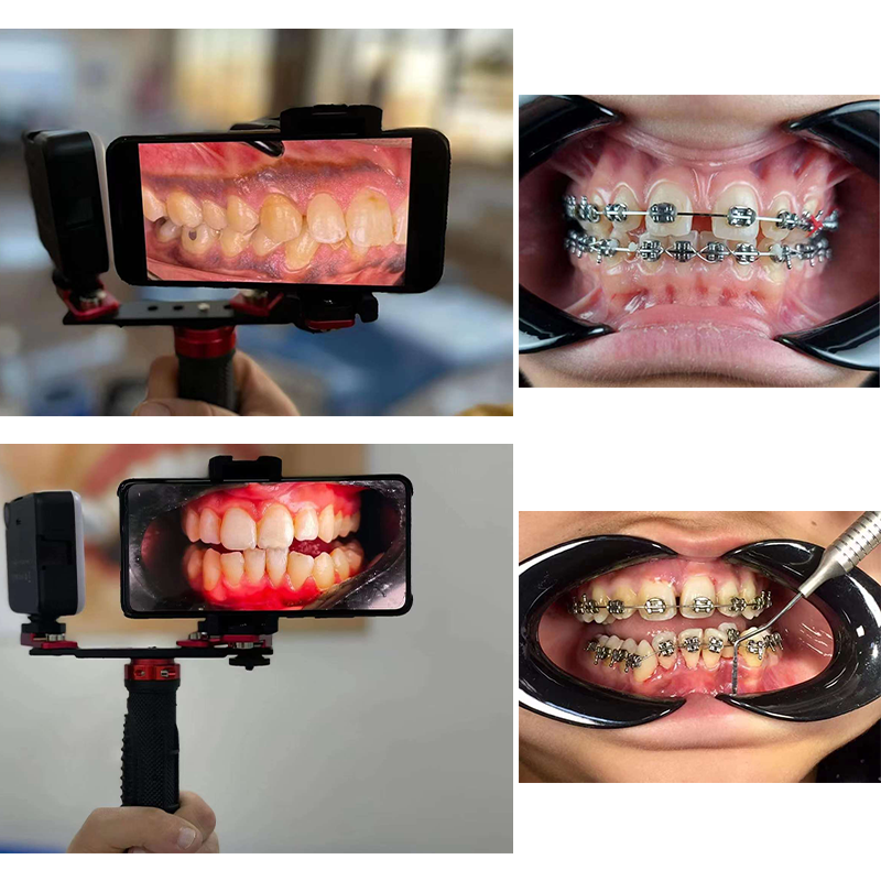 Dentistry Material Mobile Phon - Photography Mobile Lighting 리뷰 및 가격